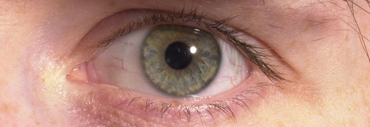<br />
<b>Notice</b>:  Undefined variable: image_alt in <b>/web/terminalfour/htdocs/courses/cpd/professional-certificate-in-glaucoma/index.php</b> on line <b>393</b><br />
