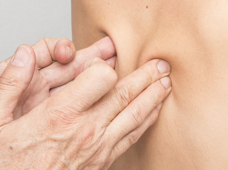 Hands pinching the skin on a persons back
